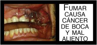 Colombia 2009 Health Effects mouth - mouth diseased, gross